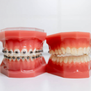 Orthodontics