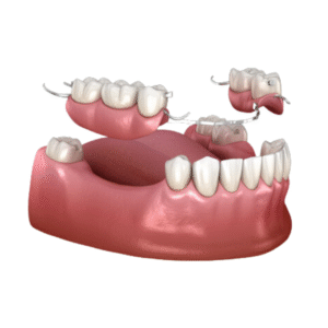 Prosthodontics