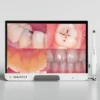 Waldent ProView Intraoral Camera System