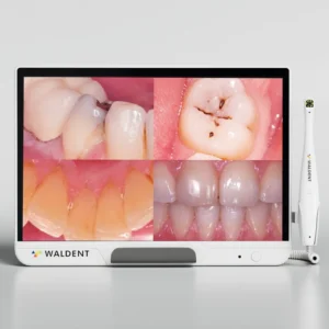 Waldent ProView Intraoral Camera System