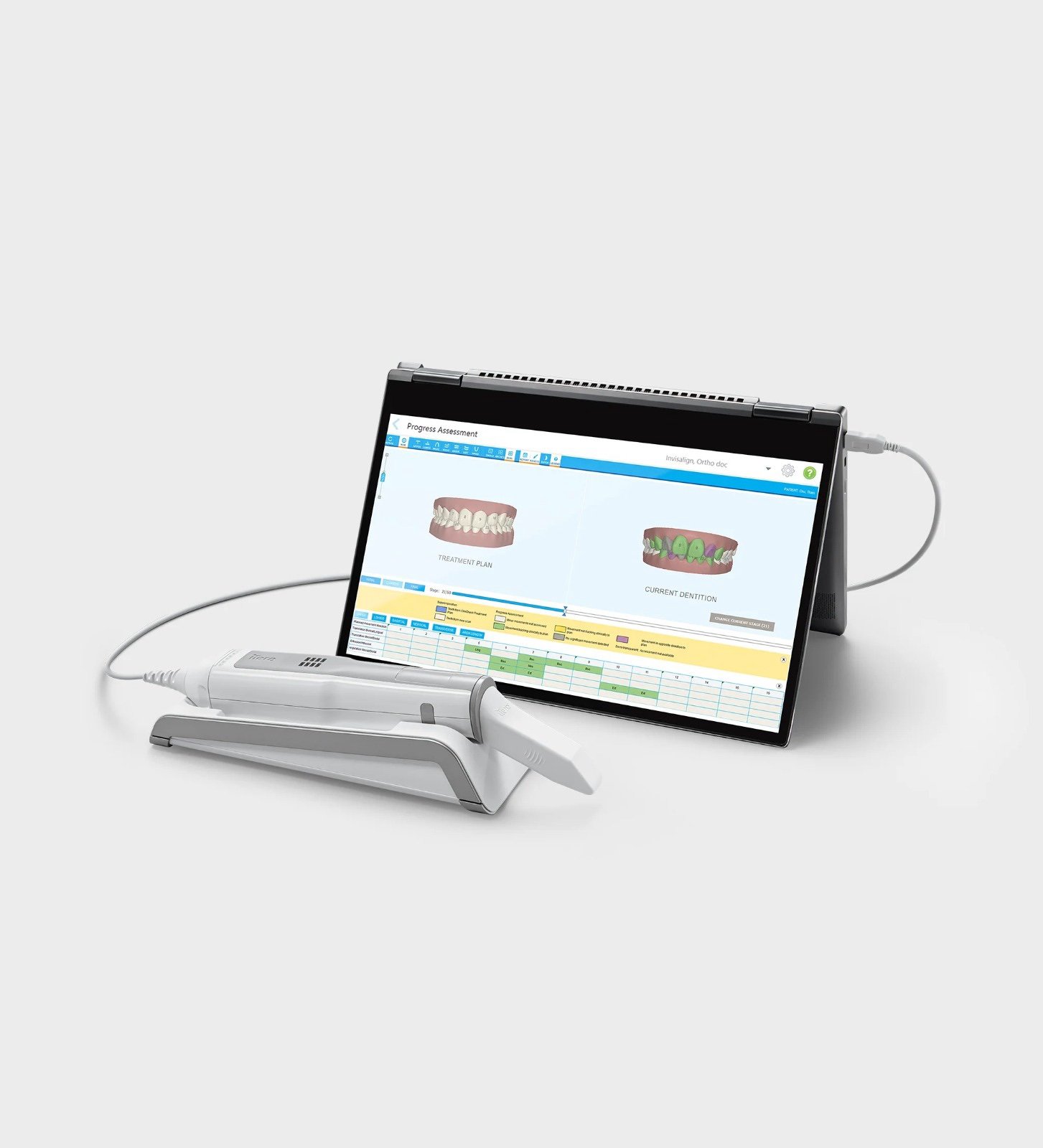 Buy iTero Element 5D Laptop (laptop not included) Online at Best